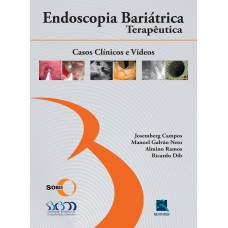 SOBED ENDOSCOPIA BARIÁTRICA TERAPÊUTICA