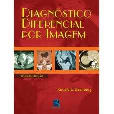 DIAGNÓSTICO DIFERENCIAL POR IMAGEM