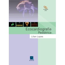 ECOCARDIOGRAFIA PEDIÁTRICA