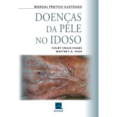 DOENÇAS DA PELE NO IDOSO