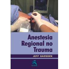 ANESTESIA REGIONAL NO TRAUMA