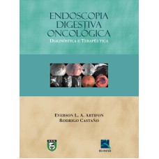 ENDOSCOPIA DIGESTIVA ONCOLÓGICA: DIAGNÓSTICO E TERAPÊUTICA