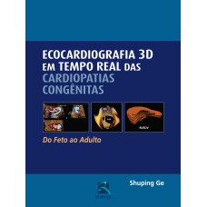 ECOCARDIOGRAFIA 3D EM TEMPO REAL DAS CARDIOPATIAS CONGÊNITAS