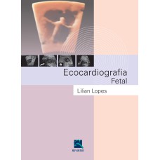 ECOCARDIOGRAFIA FETAL