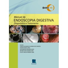 SOBED MANUAL DE ENDOSCOPIA DIGESTIVA: DIAGNÓSTICO E TRATAMENTO