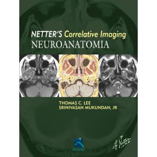 NEUROANATOMIA: NETTER''''S CURRELATIVE IMAGING