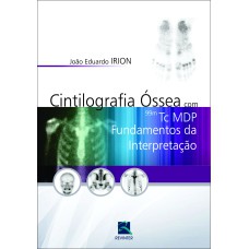 CINTILOGRAFIA ÓSSEA COM 99M TC MDP: FUNDAMENTOS DA INTERPRETAÇÃO