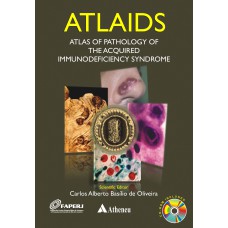 ATLAIDS - ATLAS OF PATHOLOGY OF THE ACQUIRED IMMUNODEFICIENCY SYNDROME