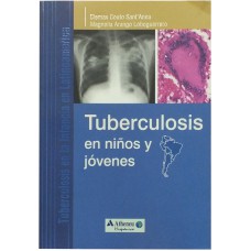 TUBERCULOSIS EN NIÑOS Y JÓVENES