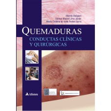 QUEMADURAS - CONDUCTAS CLINICAS Y QUIRURGICAS