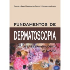 FUNDAMENTOS DE DERMATOSCOPIA