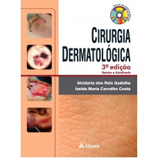 CIRURGIA DERMATOLÓGICA