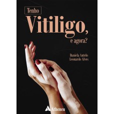 TENHO VITILIGO, E AGORA?