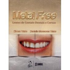 METAL FREE - LENTES DE CONTATO DENTAIS E COROAS