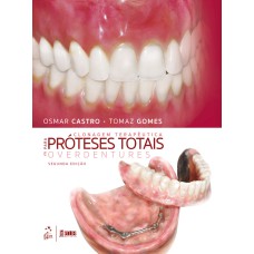 CLONAGEM TERAPÊUTICA PARA PRÓTESES TOTAIS E OVERDENTURES