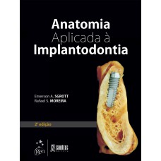 ANATOMIA APLICADA À IMPLANTODONTIA