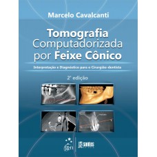 TOMOGRAFIA COMPUTADORIZADA POR FEIXE CÔNICO - INTERPRETAÇÃO E DIAGNÓSTICO PARA O CIRURGIÃO-DENTISTA