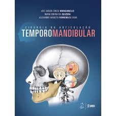 CIRURGIA DA ARTICULAÇÃO TEMPOROMANDIBULAR