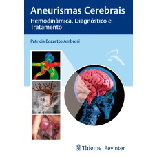 ANEURISMAS CEREBRAIS: HEMODINÂMICA, DIAGNÓSTICO E TRATAMENTO