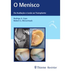 O MENISCO: DA AVALIAÇÃO E LESÃO AO TRANSPLANTE