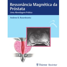 RESSONÂNCIA MAGNÉTICA DA PRÓSTATA: UMA ABORDAGEM PRÁTICA