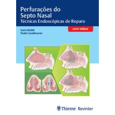 PERFURAÇÕES DO SEPTO NASAL: TÉCNICAS ENDOSCÓPICAS DE REPARO