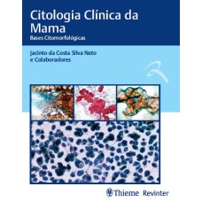 CITOLOGIA CLÍNICA DA MAMA: BASES CITOMORFOLÓGICAS