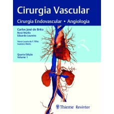 CIRURGIA VASCULAR: CIRURGIA ENDOVASCULAR, ANGIOLGIA