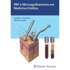 PRP E MICROAGULHAMENTO EM MEDICINA ESTÉTICA