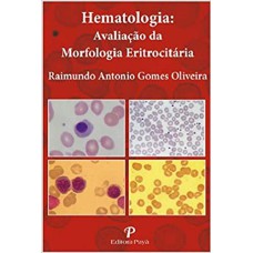 HEMATOLOGIA - AVALIAÇÃO DA MORFOLOGIA ERITROCITÁRIA - PRANCHAS