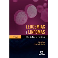 LEUCEMIAS E LINFOMAS - ATLAS DO SANGUE PERIFERICO - 2