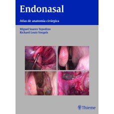 ENDONASAL: ATLAS DE ANATOMIA CIRÚRGICA