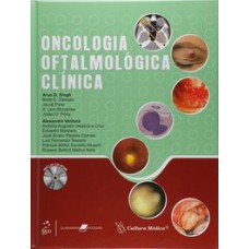 ONCOLOGIA OFTALMOLÓGICA CLÍNICA