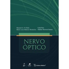 NERVO ÓPTICO