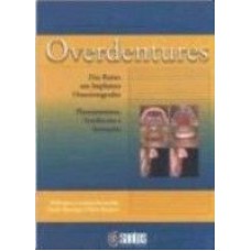 OVERDENTURES - DAS RAIZES AOS IMPLANTES OSSEOINTEGRADOS