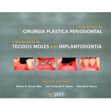 ATLAS CLÍNICO DE CIRURGIA PLÁSTICA PERIODONTAL