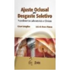 AJUSTE OCLUSAL POR DESGATE SELETIVO - PROCEDIMENTOS...