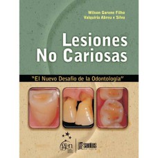 LESIONES NO CARIOSAS - EL NUEVO DESAFÍO DE LA ODONTOLOGÍA