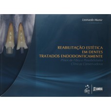 REAB.ESTÉTICA DENTES TRATADOS ENDODONTICAMENTE-PINOS DE FIBRA POSSIBILIDADES CLÍNICAS CONSERVADORAS