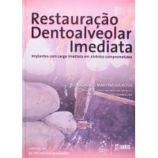 RESTAURAÇÃO DENTOALVEOLAR IMEDIATA - IMPLANTES COM CARGA IMEDIATA EM ALVÉOLOS COMPROMETIDOS