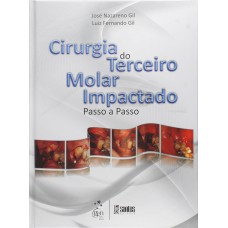 CIRURGIA DO TERCEIRO MOLAR IMPACTADO - PASSO A PASSO