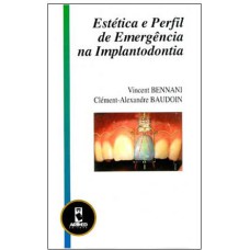 ESTÉTICA E PERFIL DE EMERGÊNCIA NA IMPLANTODONTIA