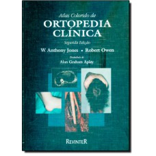 ATLAS COLORIDO DE ORTOPEDIA CLINICA - 2ª