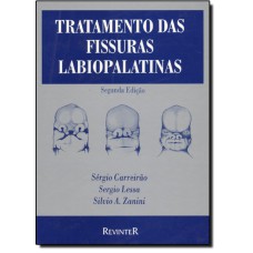 TRATAMENTO DAS FISSURAS LABIOPALATINAS - 2ª