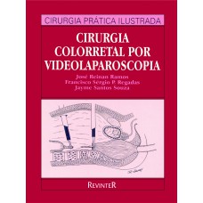 CIRURGIA COLORRETAL POR VIDEOLAPAROSCOPIA