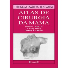 ATLAS DE CIRURGIA DA MAMA