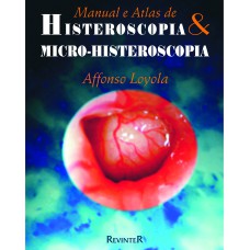 HISTEROSCOPIA E MICRO-HISTEROSCOPIA - MANUAL E ATLAS