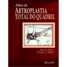 ATLAS DE ARTROPLASTIA DO QUADRIL