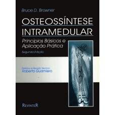 OSTEOSSÍNTESE INTRAMEDULAR