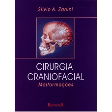 CIRURGIA CRANIOFACIAL - MALFORMAÇÕES